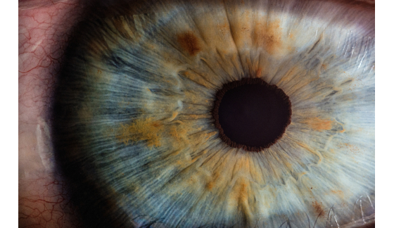 Wady wzroku - rodzaje, objawy i leczenie