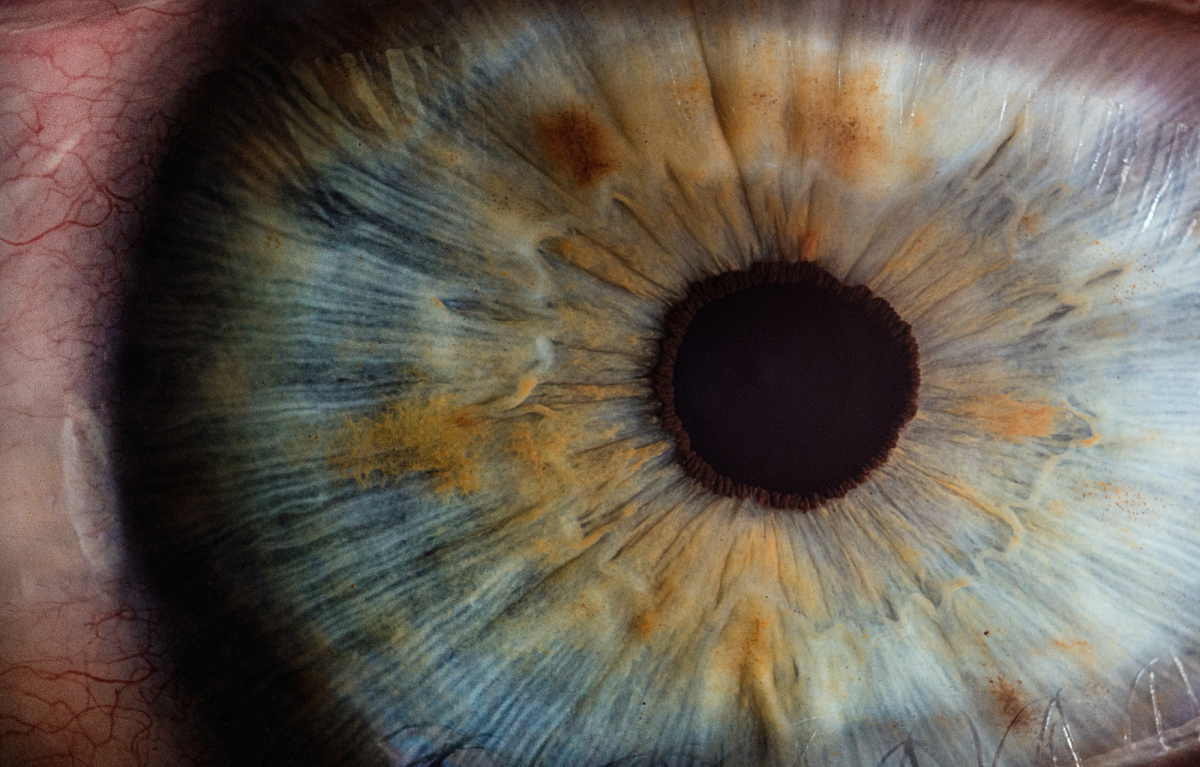 Wady wzroku - rodzaje, objawy i leczenie